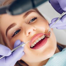 7 Reasons for Tooth Extraction in Dentistry 