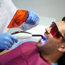 Dental Fillings Decoded: Say Goodbye to Cavities and Hello to Confidence